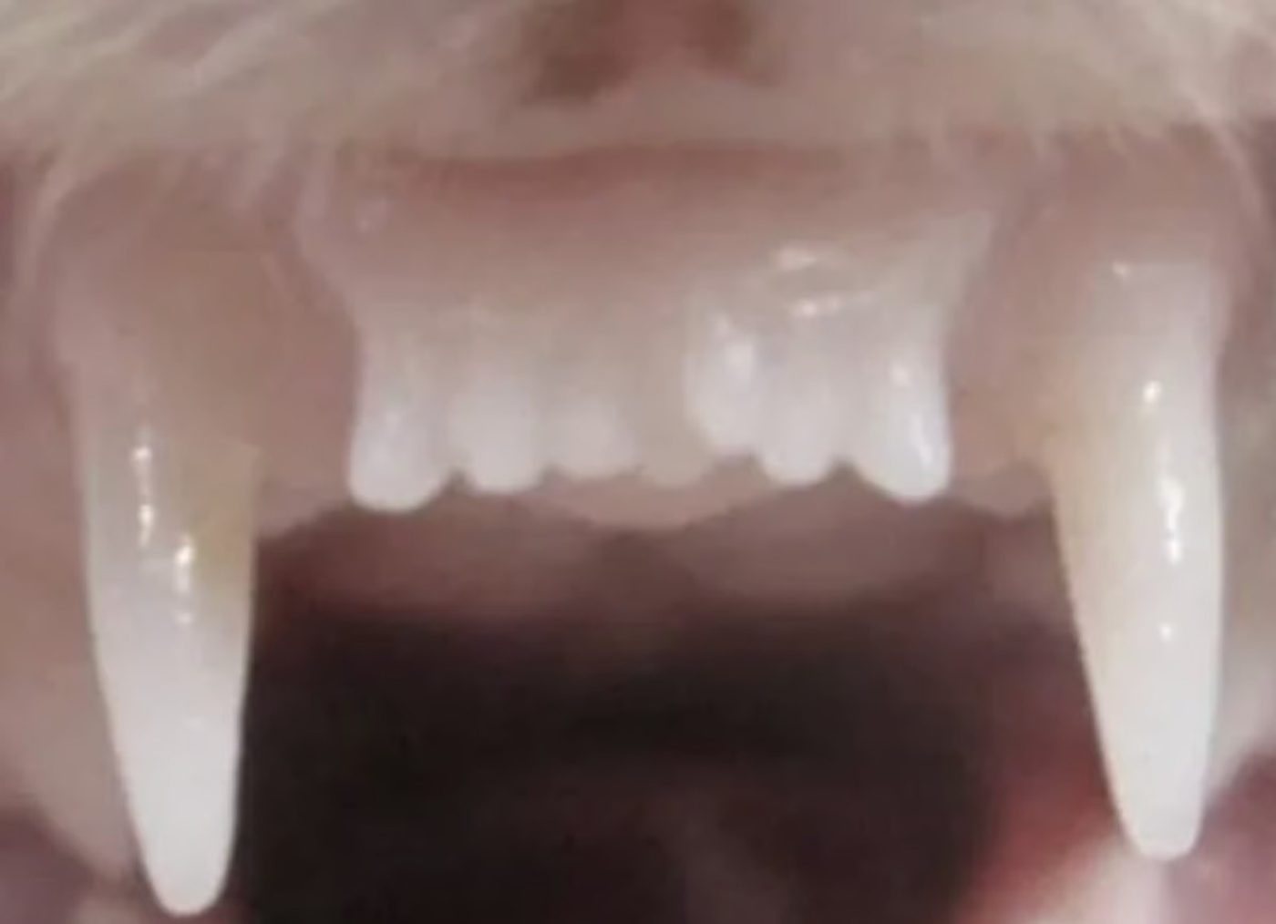 Kaybedilen Dişler İçin Umut Işığı: Diş Çıkaran İlaç İçin İnsanlı Deneyler Başladı