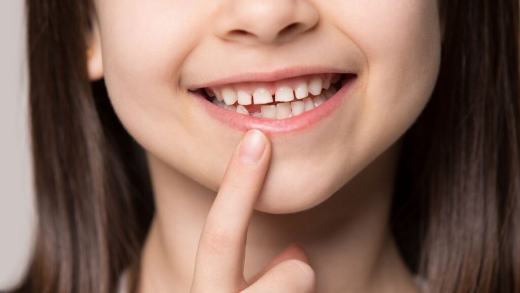 A Beacon of Hope for Lost Teeth: Human Trials Begin for Tooth Regeneration Drug
