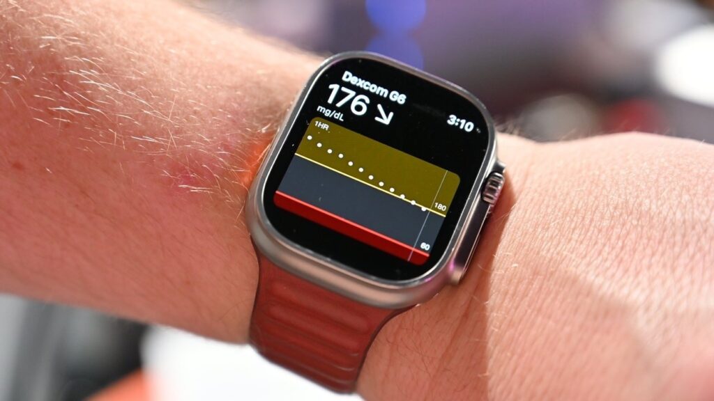 Apple Watch ve Dexcom G7 İle Artık Şeker Ölçümü Saat Üzerinden Yapılabilecek