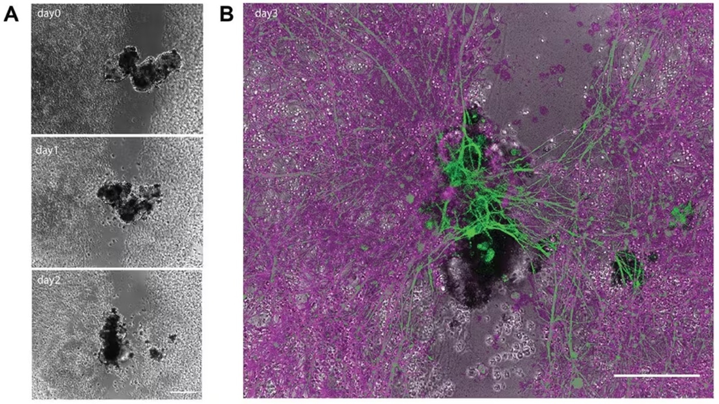 Scientists Discover a New State Between Life and Death